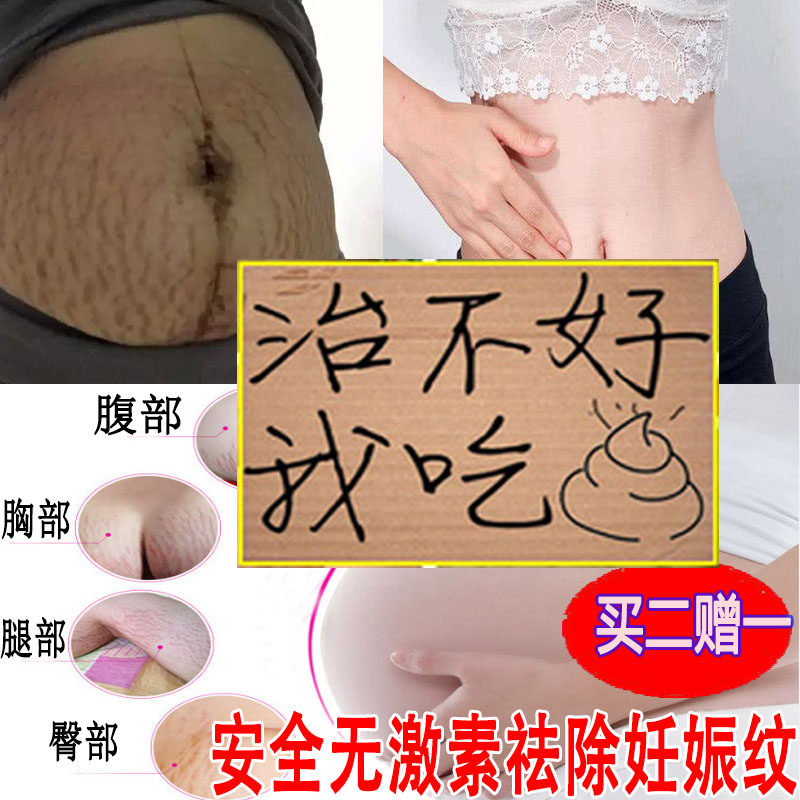 [长金美妆妊娠纹护理]正品预防去除妊娠纹产后修复消除紧致松月销量203件仅售79元