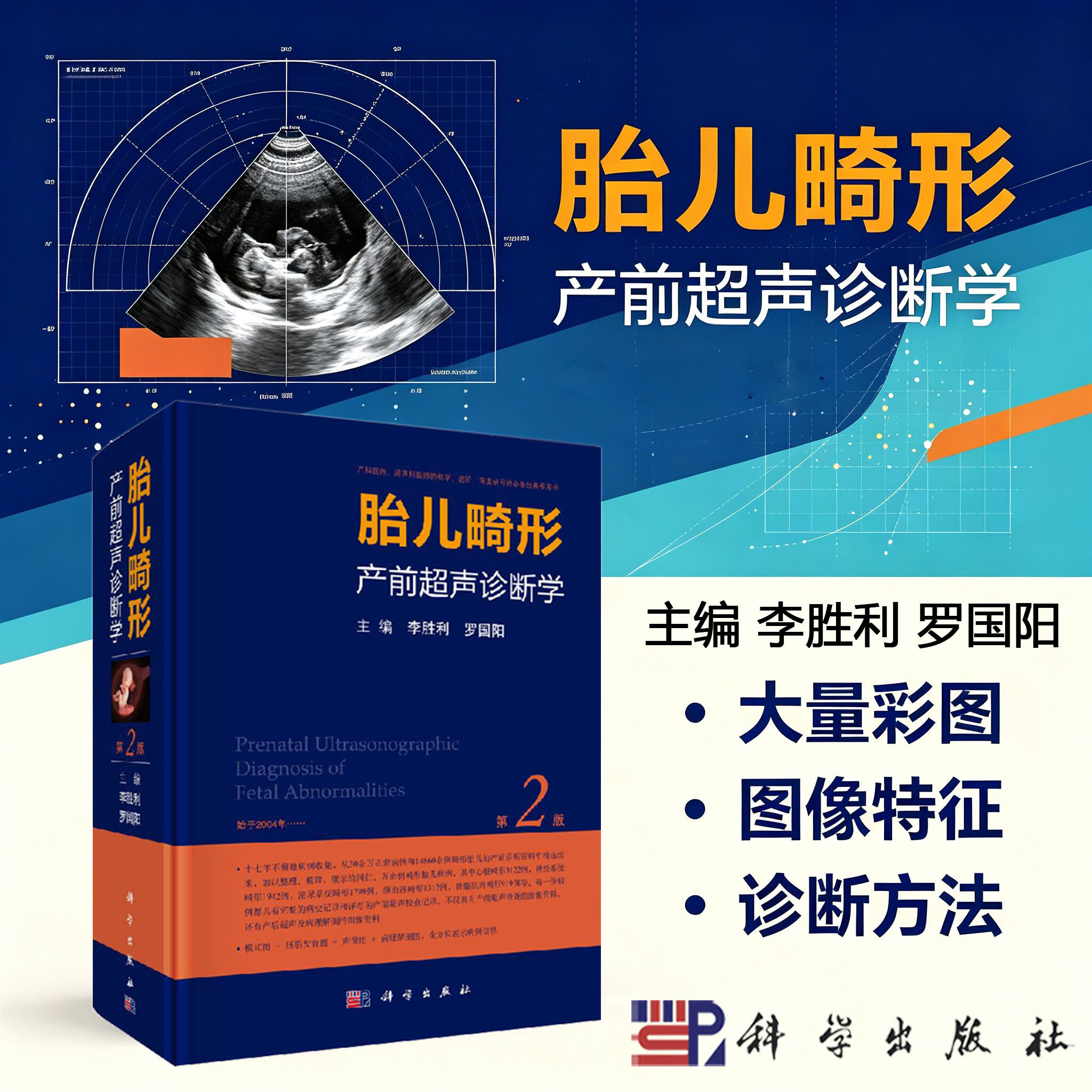 现货包邮胎儿畸形超声诊断学二版