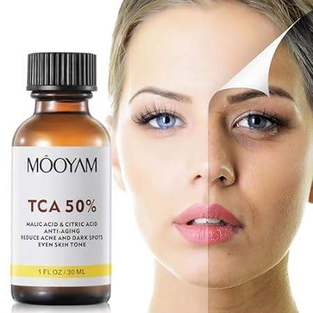Peeling Serum Chemical Exfoliant for Face with 50% Citric