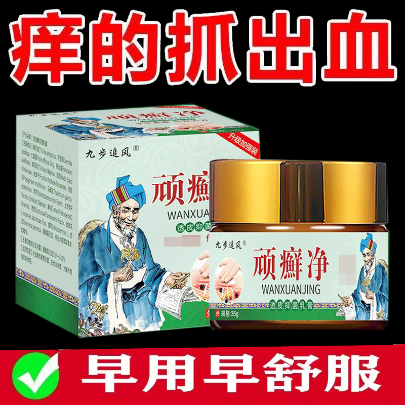 正品九步追风顽癣净抑菌乳膏皮肤瘙痒外用35g