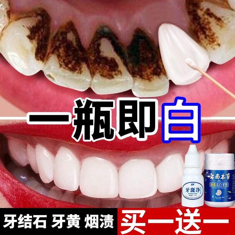 牙斑净正品洗白去牙齿黑渍除垢污垢除牙石速效烟渍洗黑牙氟斑牙