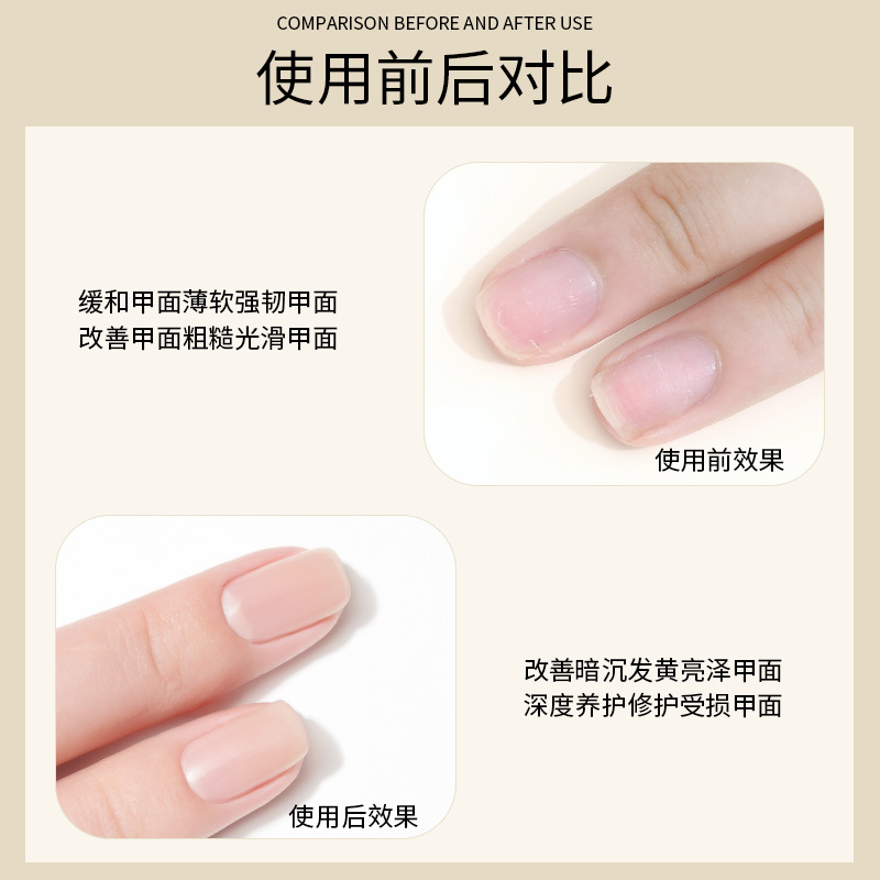 美甲护甲油营养油死皮软化剂套装去角质防倒刺营养油指甲护理工具