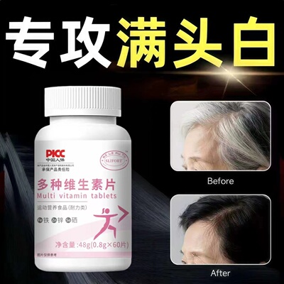 SLIFORT铁锌维乌发强韧片