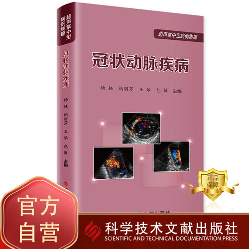 超声掌中宝系列影像医学书