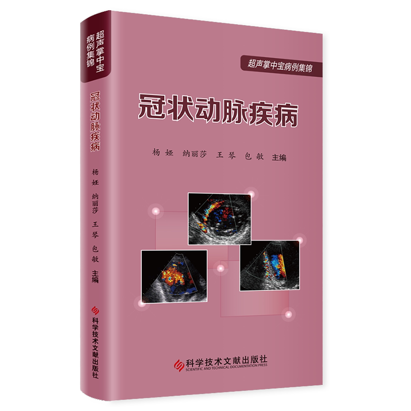 超声掌中宝系列影像医学书
