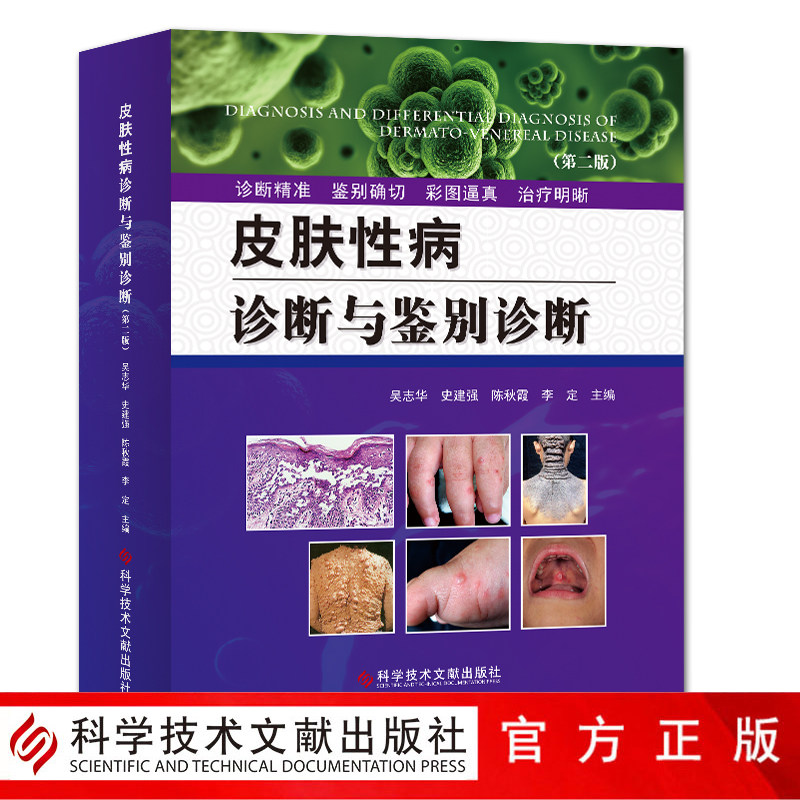 正版包邮皮肤性病诊断与鉴别诊断（第二版）吴志华皮肤病诊断性病诊断皮肤科镜诊断医生工具书彩色图谱学书籍科学技术文献出版社