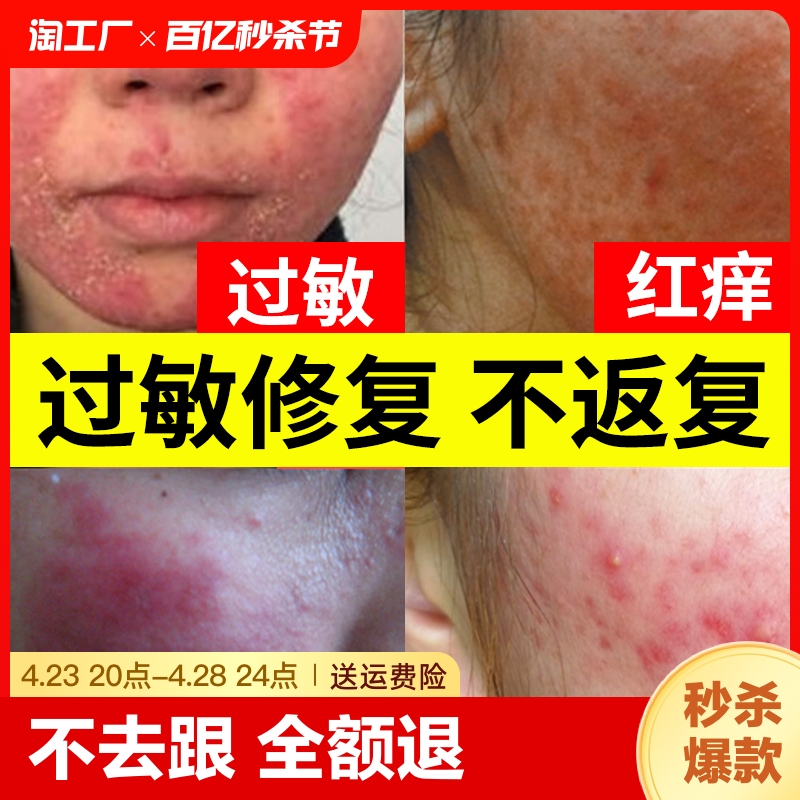 已为756814人解决【脸过敏】烦恼