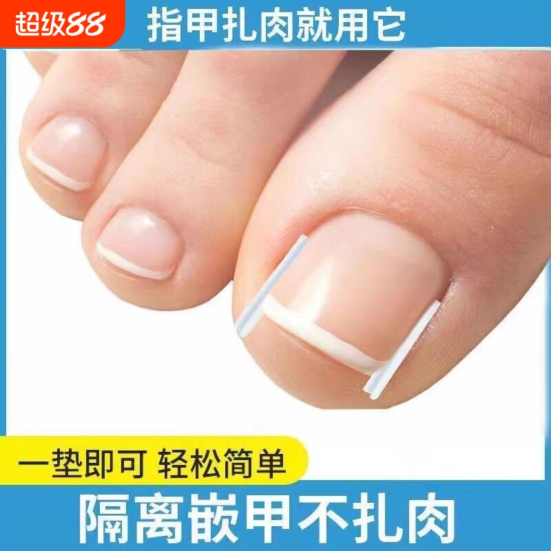 甲沟垫嵌甲指甲矫正器填充垫片正甲贴脚趾甲长肉里专用修甲刀棉花