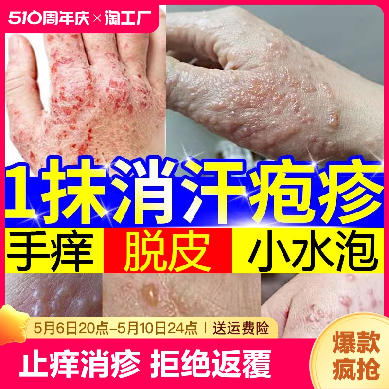 云南本草汗孢疹膏汗包膏泡疱疹手上小水泡脱皮痒汗状专用软膏成人 保健用品 皮肤消毒护理（消） 原图主图