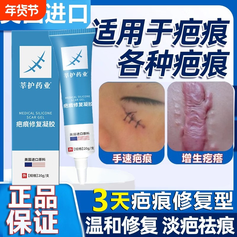巴克疤克祛疤膏疤痕修复去除疤凝胶增生凸起疙瘩正品官方旗舰店