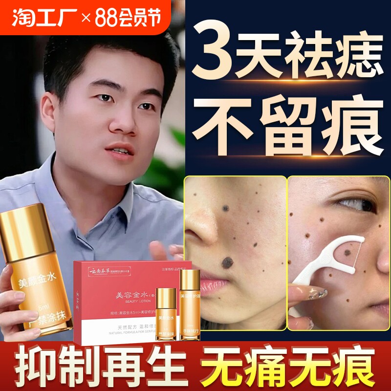 点痣药膏点痦子药水去痣取疣去志膏去除神器祛痣脸部无痕正品修复