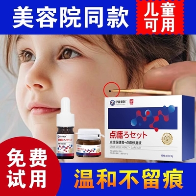 点痣膏去黑痣【销量NO.I】