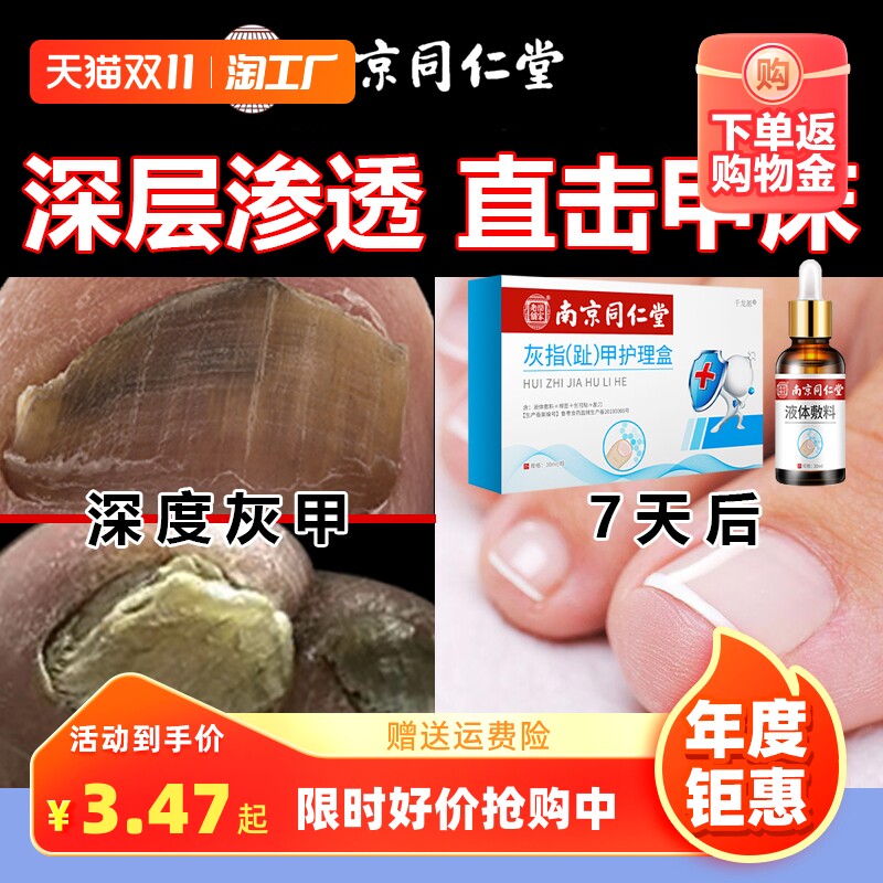 南京同仁堂灰指甲护理抑菌液冰醋酸30抗菌阿正品莫罗芬搽剂旗艦店属于什么档次？