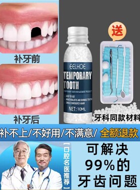 进口补牙树脂仿真牙套缺牙修复