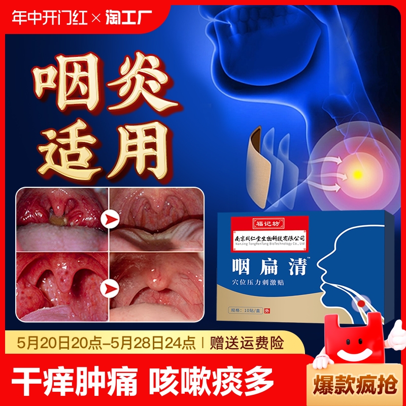 同仁堂咽喉炎慢性咽炎贴官方正品