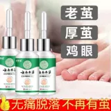 Кокосоны, коконы, кокон, мозоли, кокон, удаление кокона, уборка, уборка, депривор мертвый кожа Мягкий агент, ноги, корни ноги