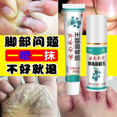 云南本草狼毒脚藓王脚气脚痒脚臭脱皮水泡烂脚丫糜烂脚趾止痒乳膏