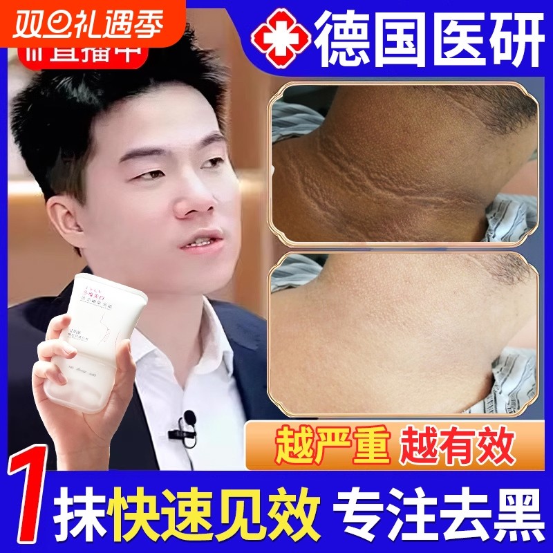 脖子黑色素去除黑棘皮症脖子黑色素沉淀洗不干净肥胖儿童美白神器