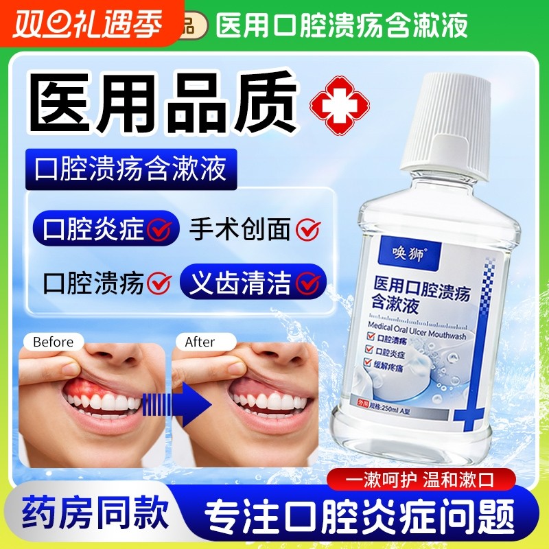 医用漱口水口腔溃疡含漱液口腔炎症牙龈出血义齿手术创面缓解疼痛