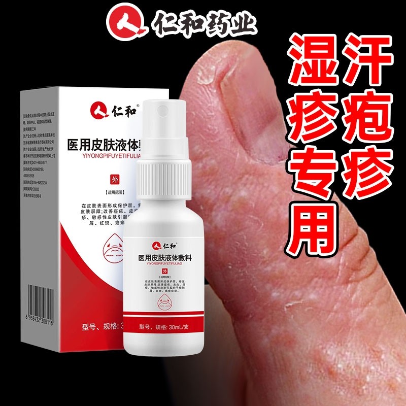 汗泡疱疹汗疱疹湿疹真菌感染正品痱子去手上起小水泡止痒非药膏