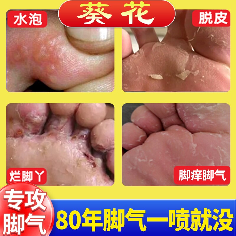 1��װ�������Ƕ��ų�������� �����Ƕ���������ֹ����Ƥɱ���ų���ˮ���ý�Ѿ�����Ⱦר�����