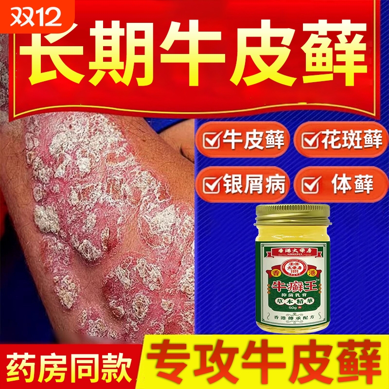 香港牛藓王牛皮痒癣头皮股银去屑病专用膏正品皮肤杀菌止抑菌痒