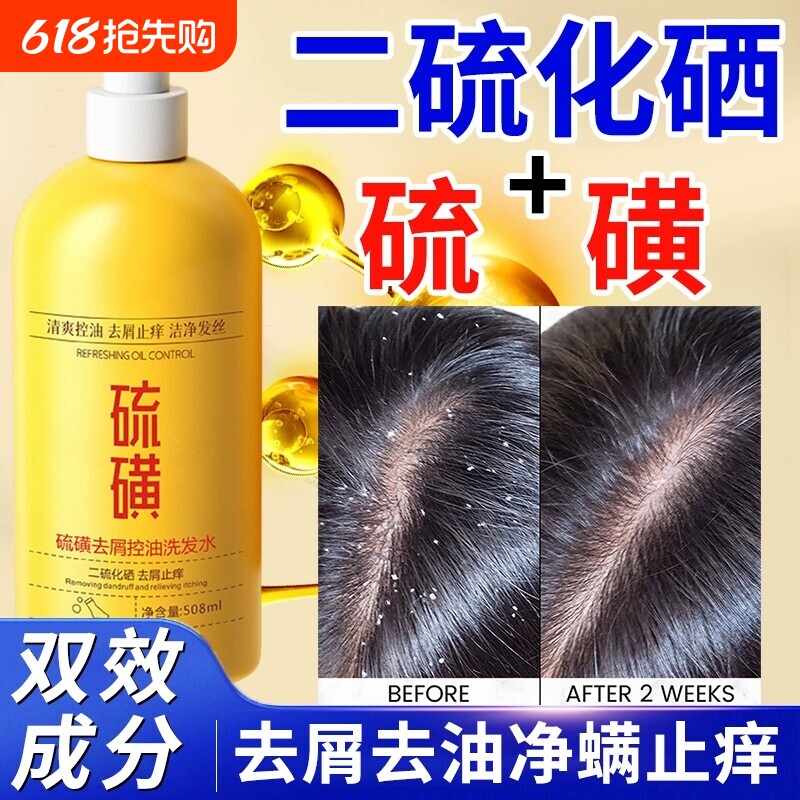 二硫化硒硫磺洗发水洗头膏毛囊去屑止痒沐浴露清洁去油头屑蓬松