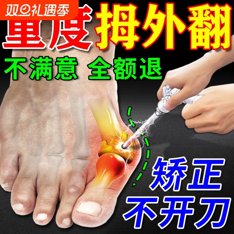 拇指外翻药膏贴拇囊炎疼痛大脚骨变形脚趾畸形肿胀矫正神器女克星
