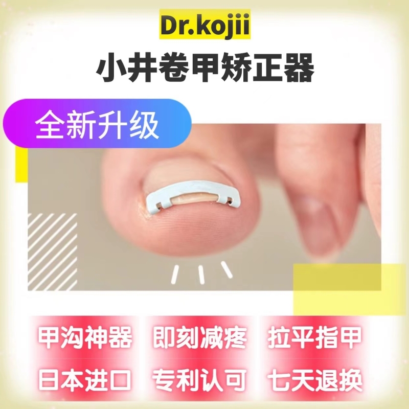 甲沟矫正器贴嵌甲正甲扣脚趾甲贴片纠正指甲卷拉拉炎肉神器小井