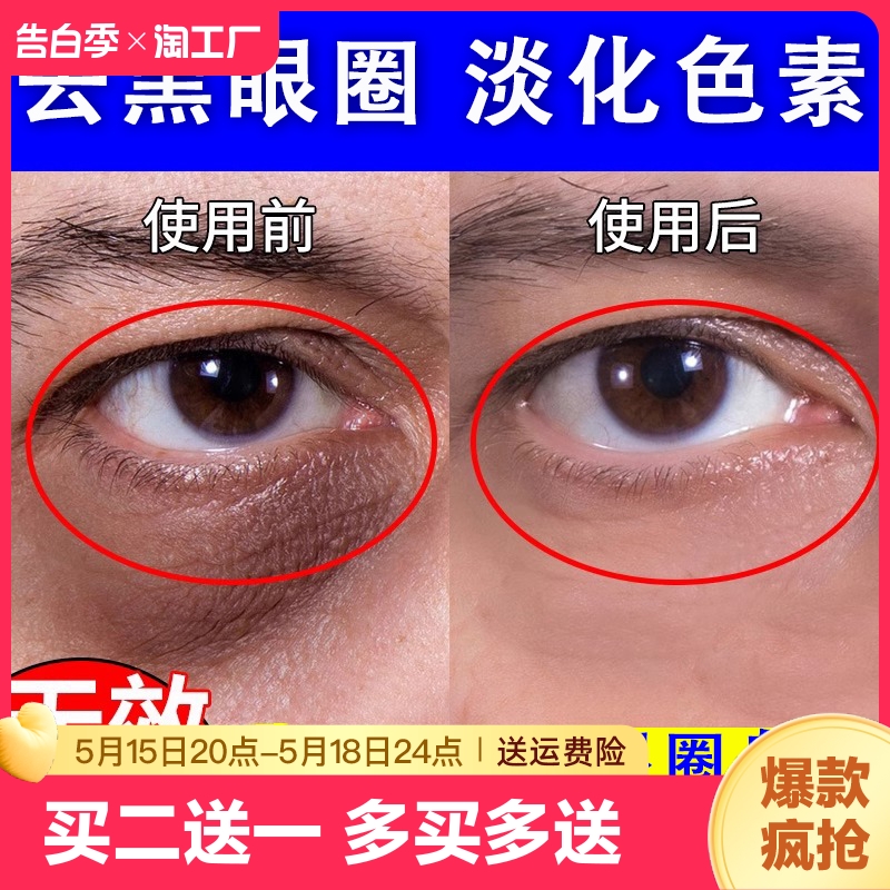 眼膜淡化黑眼圈细纹药膏贴抗衰去黑色素沉淀去除眼袋医用导光凝胶