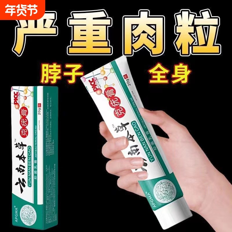 【去脖子肉粒】快速克尤抑菌液颈部赘皮祛丝状腋下猴子足部磨砂膏