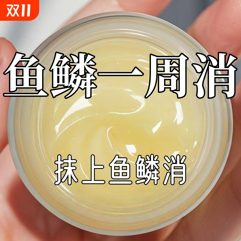 鱼鳞皮乳霜干燥起皮痒掉皮屑护理