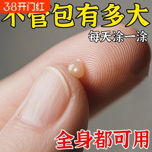 香港脂肪康脂肪瘤皮下鼓包硬块凸起肿块草本手脚全身正品涂抹霜