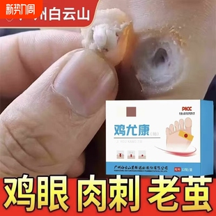 鸡眼贴去鸡眼神器老茧鸡贴眼脚钉祛除膏鸡茧眼足部鸡贴眼膏正品
