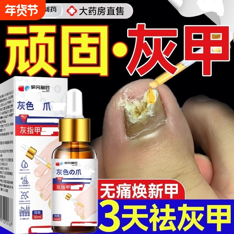 灰指甲专用抑菌液趾甲膏变厚治涂剂冰醋酸男正品旗舰店修复无痛,医疗器械,保健理疗,淘宝优惠券,粉丝福利购,淘宝优惠卷