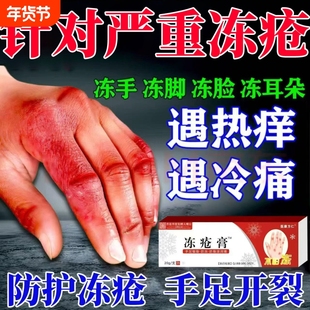 防冻防裂冻疮膏止痒冻伤膏排行榜第一名儿童成人手耳朵官方旗舰店