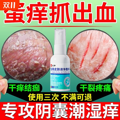 阴囊湿疹瘙痒拒反复【销量No.I】