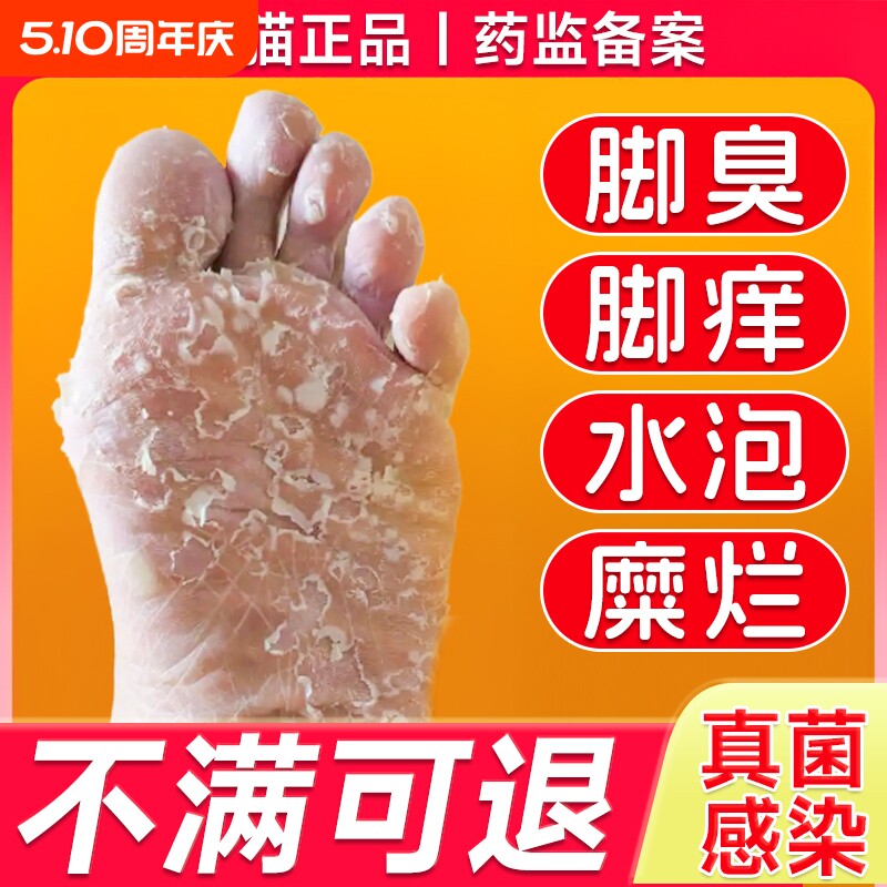 脚气喷雾止痒脱皮杀菌真菌感染专用臭脚痒出汗脚泡脚根趾缝糜烂痒