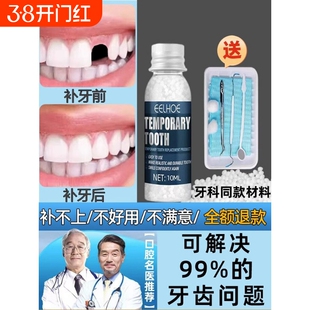 进口修补神器自己补牙材料树脂假德国牙套牙仿真牙齿缺牙填充修复