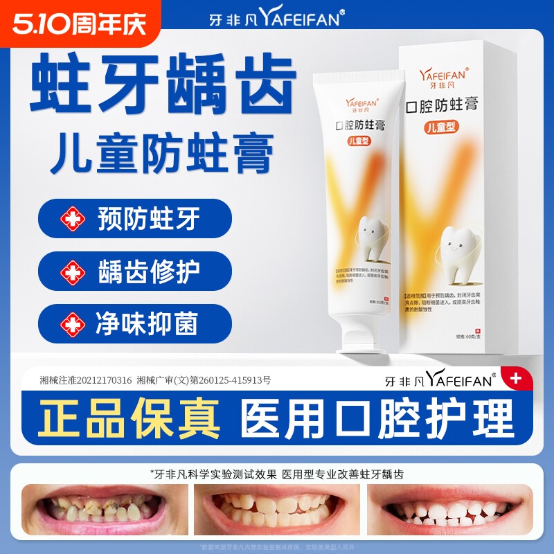 牙非凡儿童口腔防蛀膏防龋齿固齿封闭牙窝沟点隙牙菌斑牙膏s修复
