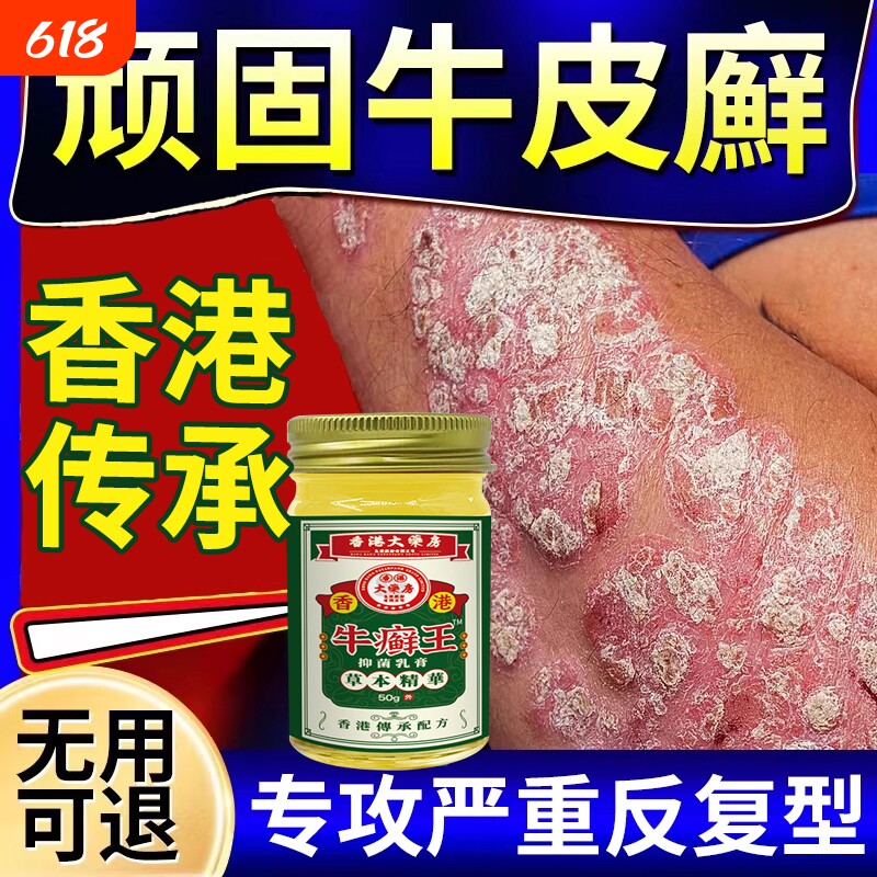 香港牛藓王治疗牛皮藓癣银屑专用膏去屑病皮肤杀菌症效痒特正品