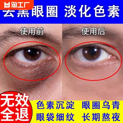 眼膜淡化黑眼圈细纹药膏贴抗衰去黑色素沉淀去除眼袋医用导光凝胶