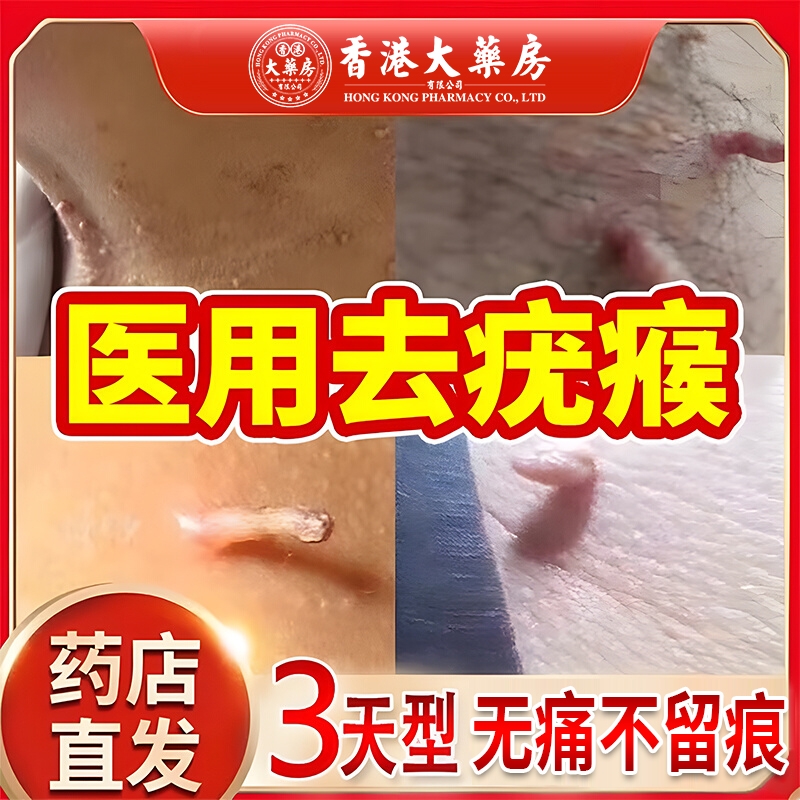 香港大药房点疣膏【销量NO.I】