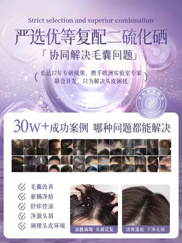 Шампунь для кожи головы, лечебный кондиционер, удаление перхоти, против зуда, контроль жирного блеска, придает объем