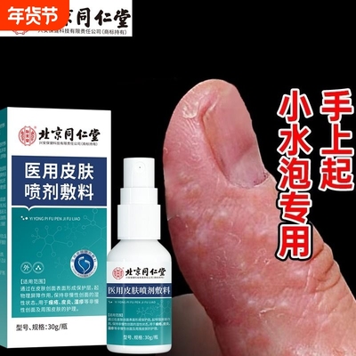 汗泡疱疹汗疱疹湿疹真菌感染去手上起小水泡止痒非药膏根皮肤瘙痒