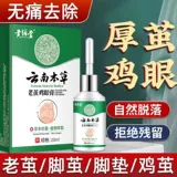 Кокосоны, коконы, кокон, мозоли, кокон, удаление кокона, уборка, уборка, депривор мертвый кожа Мягкий агент, ноги, корни ноги