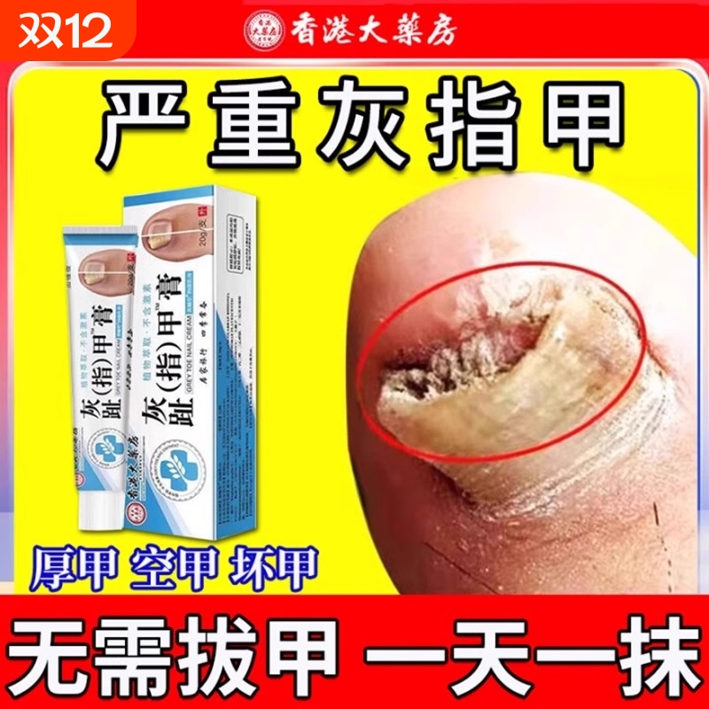 香港灰趾甲膏销量NO.I