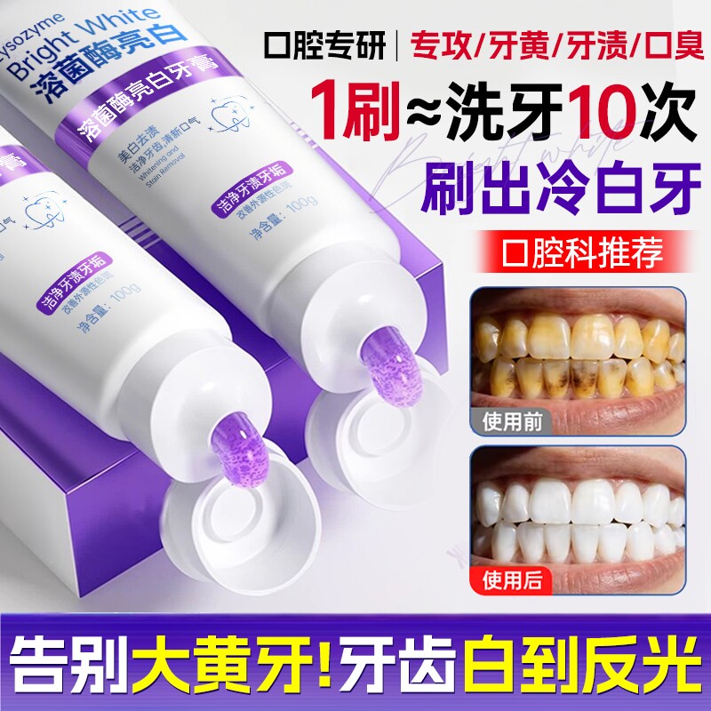 牙膏美白去黄去口臭除异味口气清新速效洗白女男专用成人正品官方