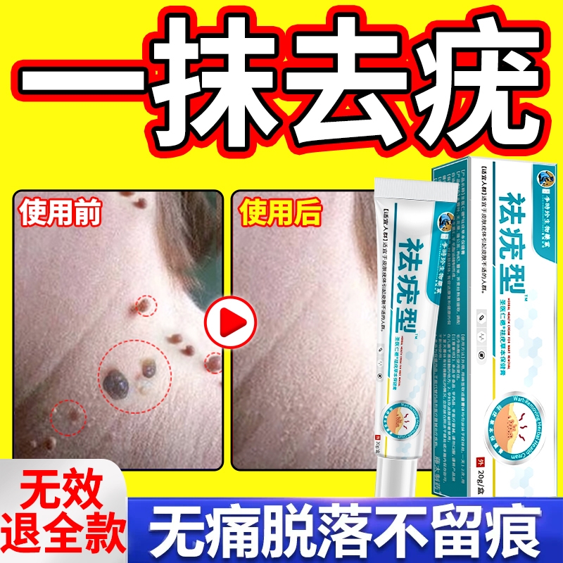 去扁平疣一抹灵|349人收藏