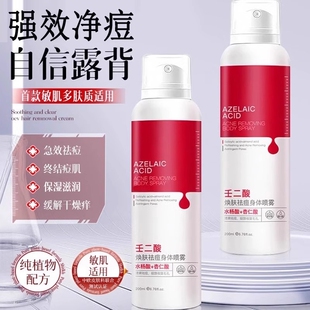 身体祛痘喷雾去痘印后背长背粒除背部神器上痘痘前胸200ml*1瓶起